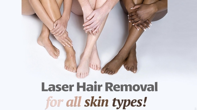 Smooth and Fuss-Free: Your Guide to Laser Hair Removal