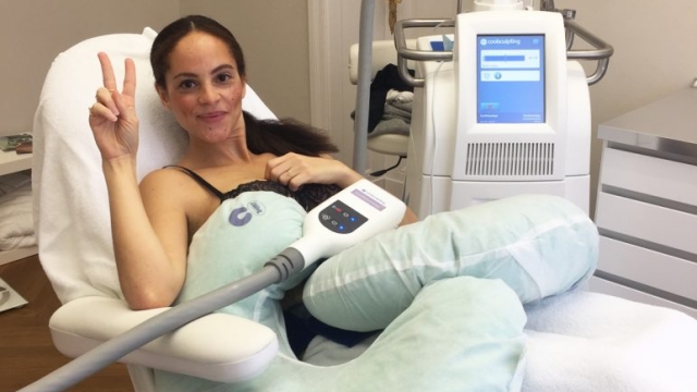 Chill your Way to a Sculpted Body: Exploring the Power of Cool Sculpting