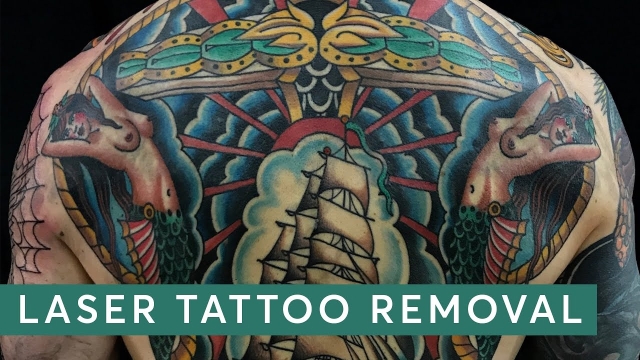 How To Remove Tattoos Yourself – Redecorating Tattoo Removal