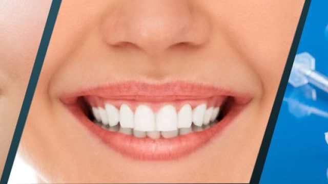 Brighten Your Smile: Unveiling the Secrets of Teeth Whitening