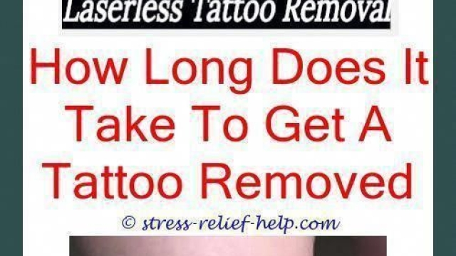 Low Cost Tattoo Removal – Your Solution For Unwanted Tattoo