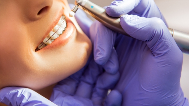The Art of Smiles: Unveiling the Secrets of Orthodontics