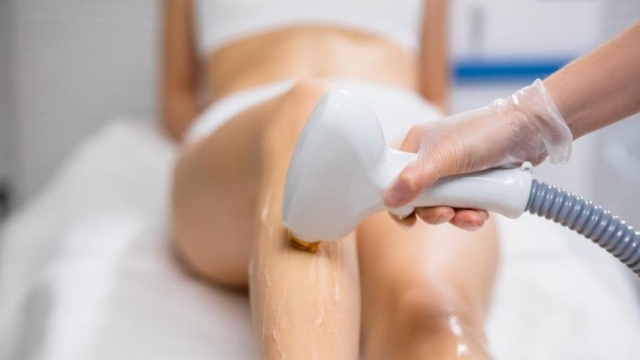 Unveiling the Secrets of Laser Hair Removal: A Smooth Path to Perfection