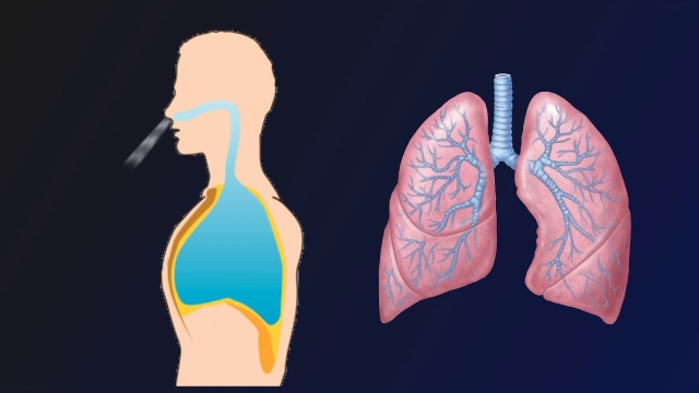 Breathing Easy: The Evolution of Inhalation Devices